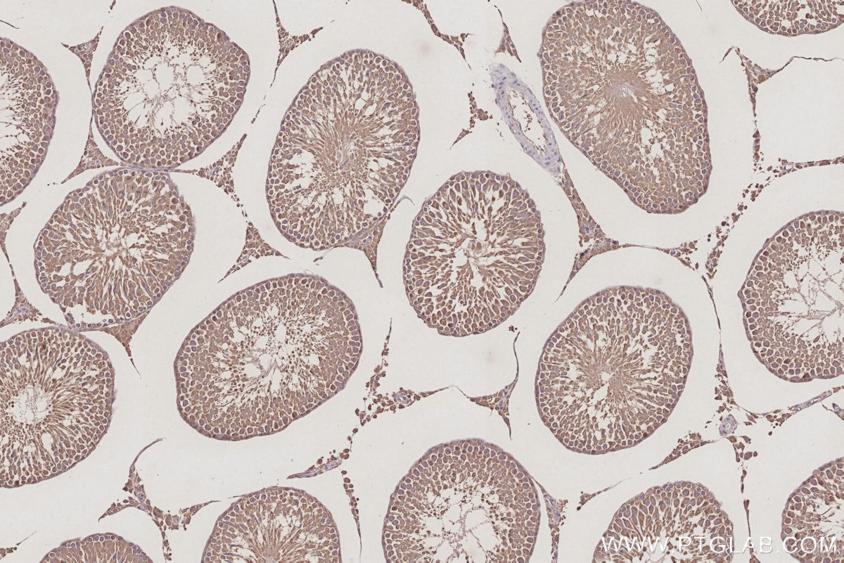 Immunohistochemical analysis of paraffin-embedded rat testis tissue slide using KHC3022 (FEM1B IHC Kit).