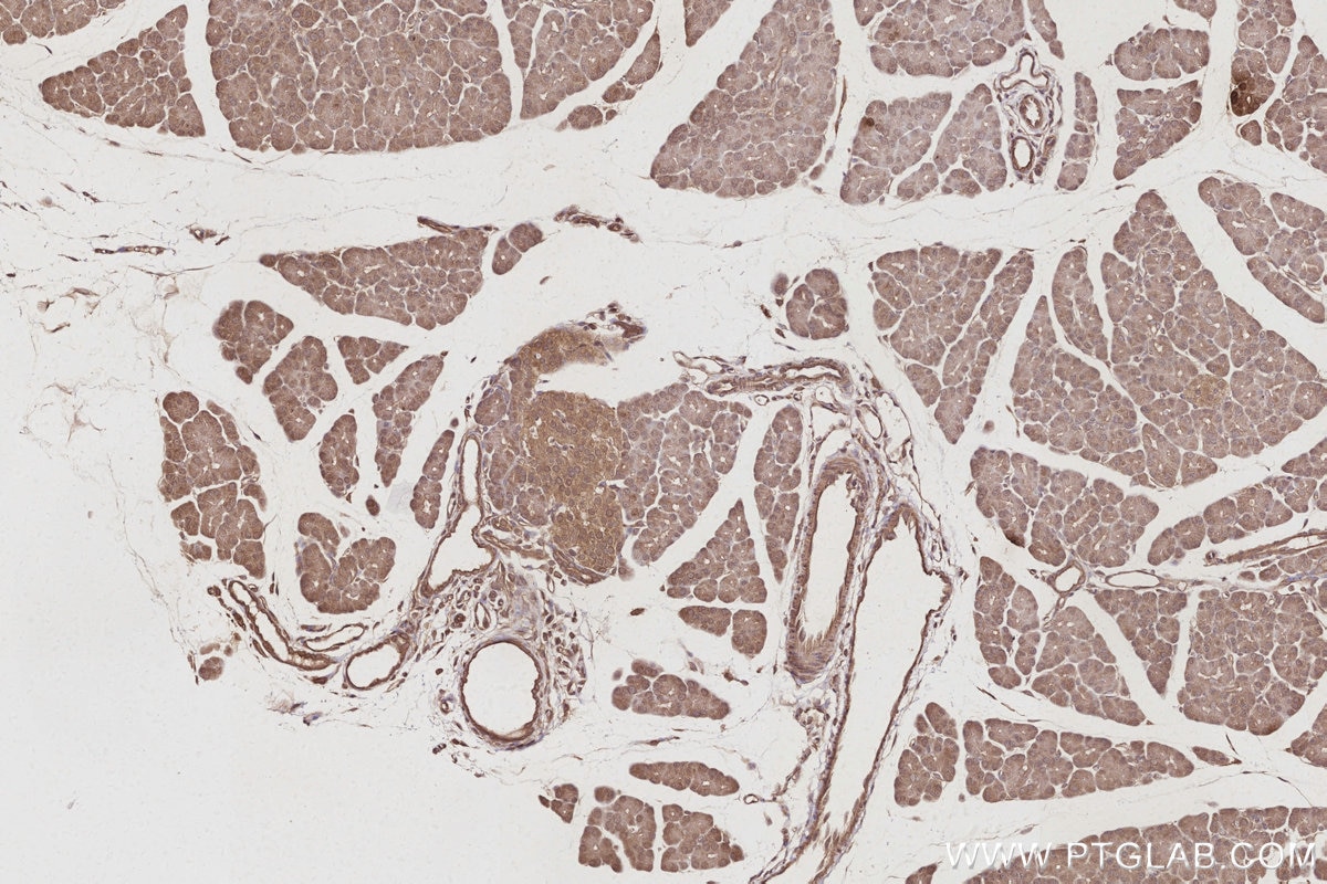 Immunohistochemical analysis of paraffin-embedded rat pancreas tissue slide using KHC3022 (FEM1B IHC Kit).