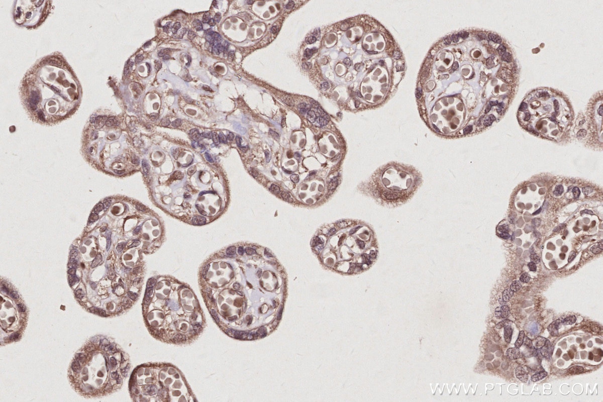 Immunohistochemical analysis of paraffin-embedded human placenta tissue slide using KHC3022 (FEM1B IHC Kit).
