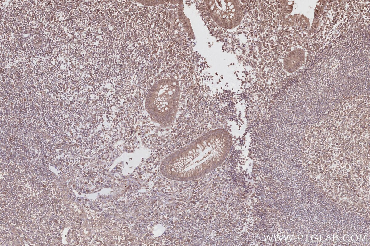 Immunohistochemical analysis of paraffin-embedded human appendicitis tissue slide using KHC2802 (FEM1C IHC Kit).