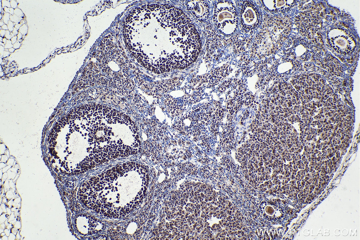 Immunohistochemical analysis of paraffin-embedded mouse ovary tissue slide using KHC2256 (FEN1 IHC Kit).