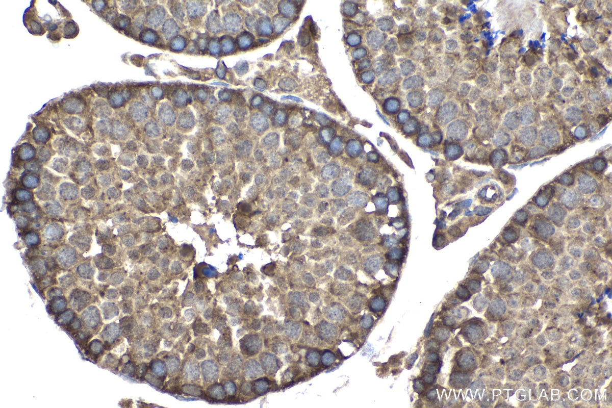 Immunohistochemical analysis of paraffin-embedded mouse testis tissue slide using KHC1538 (FER IHC Kit).