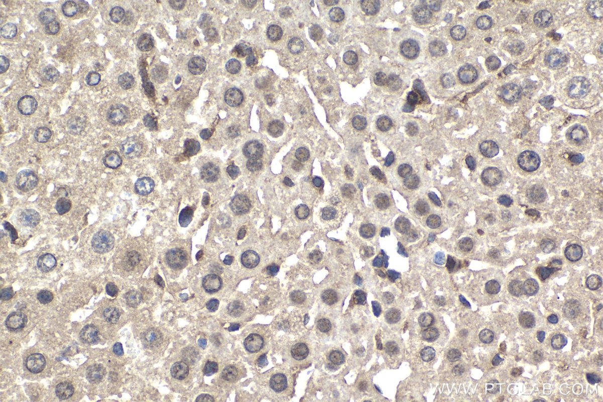 Immunohistochemical analysis of paraffin-embedded mouse liver tissue slide using KHC1538 (FER IHC Kit).