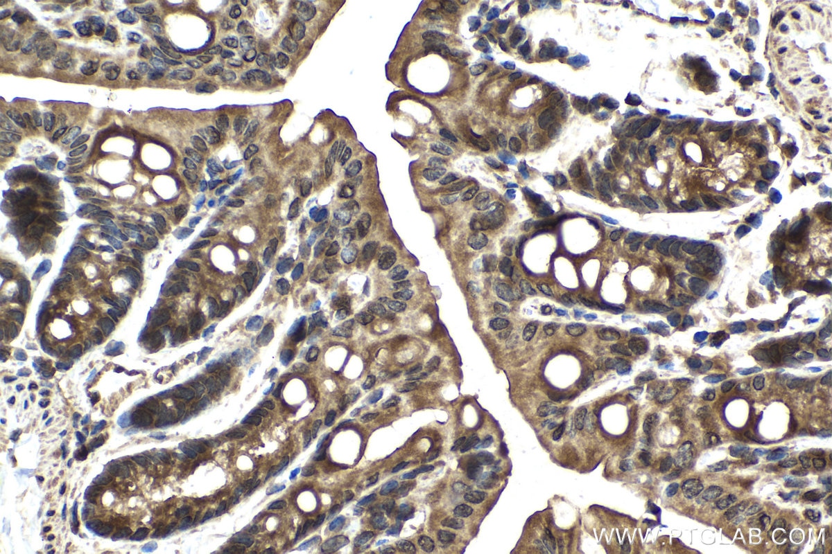 Immunohistochemical analysis of paraffin-embedded mouse colon tissue slide using KHC1538 (FER IHC Kit).