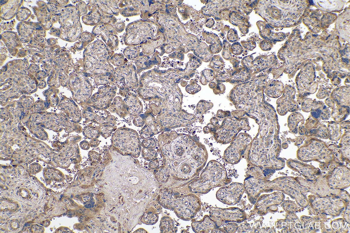 Immunohistochemical analysis of paraffin-embedded human placenta tissue slide using KHC0775 (FERMT1/Kindlin 1 IHC Kit).