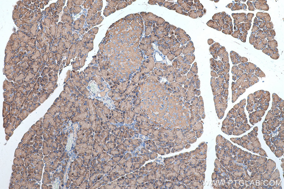 Immunohistochemical analysis of paraffin-embedded rat pancreas tissue slide using KHC0688 (FERMT2/Kindlin 2 IHC Kit).