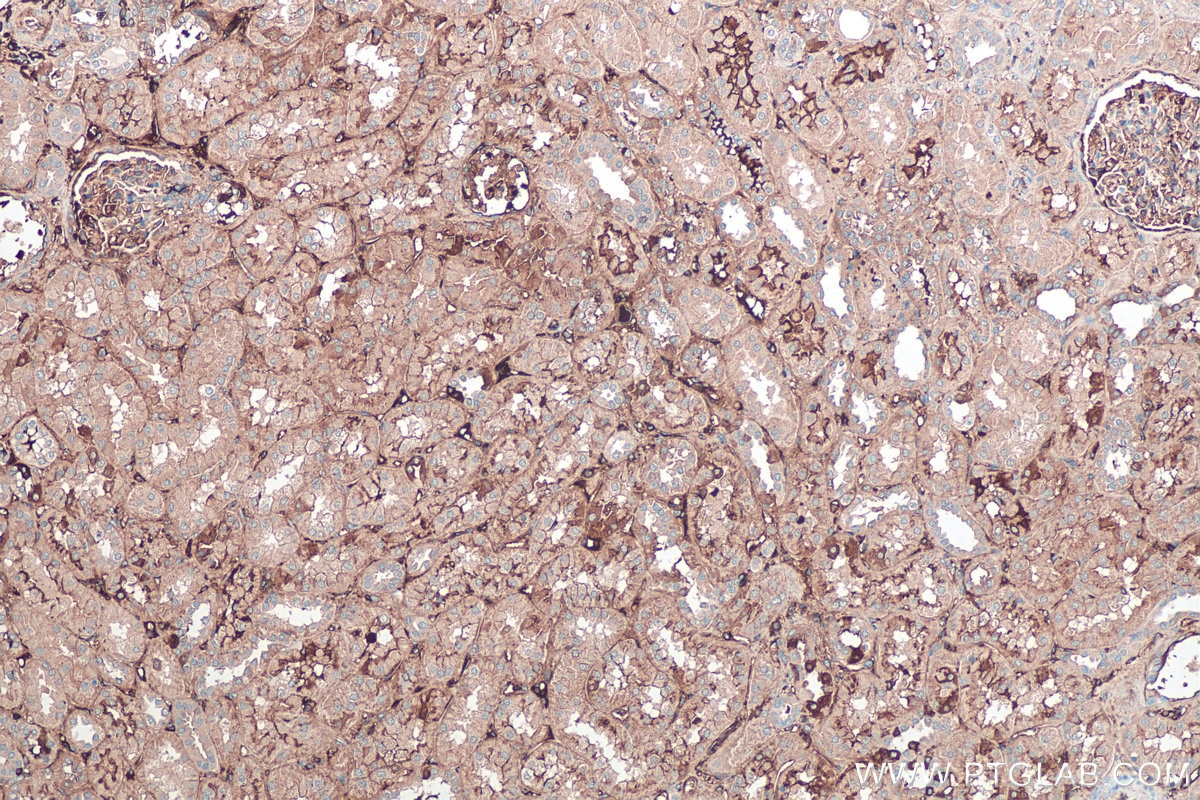 Immunohistochemical analysis of paraffin-embedded human kidney tissue slide using KHC0388 (Fibrinogen Beta Chain IHC Kit).