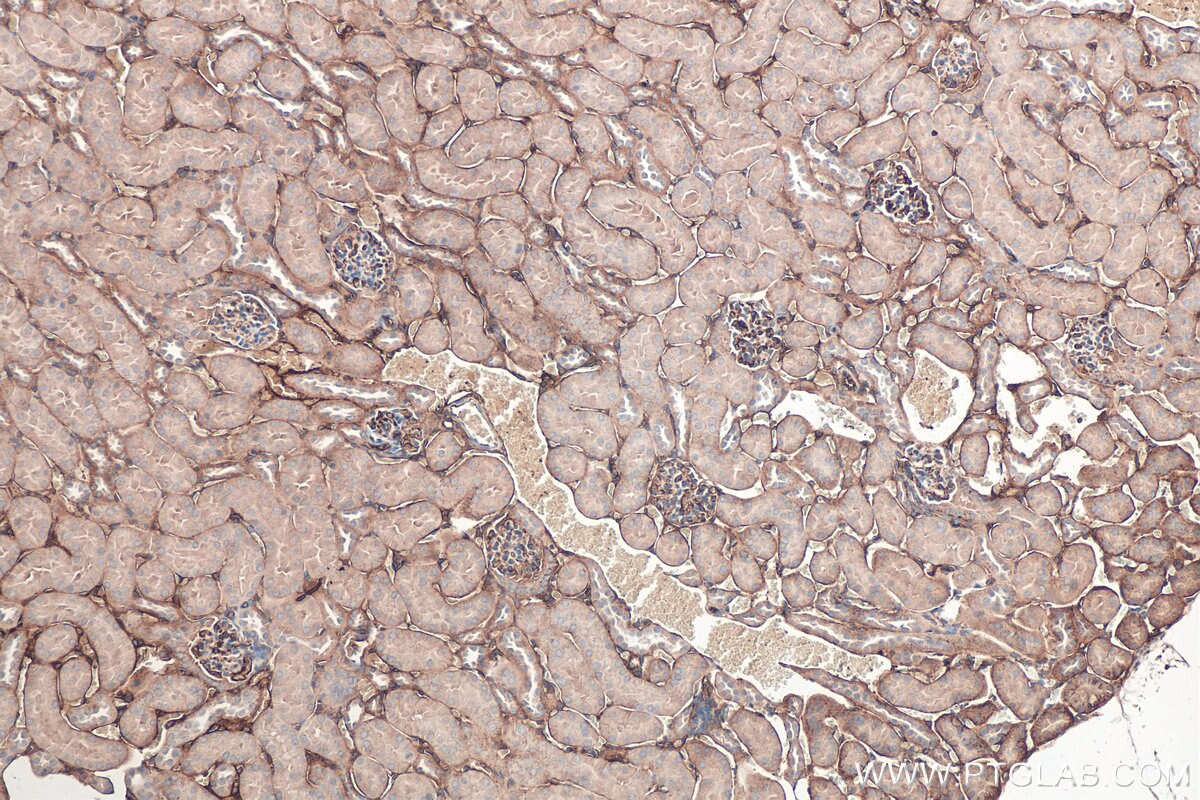 Immunohistochemical analysis of paraffin-embedded mouse kidney tissue slide using KHC0388 (Fibrinogen Beta Chain IHC Kit).