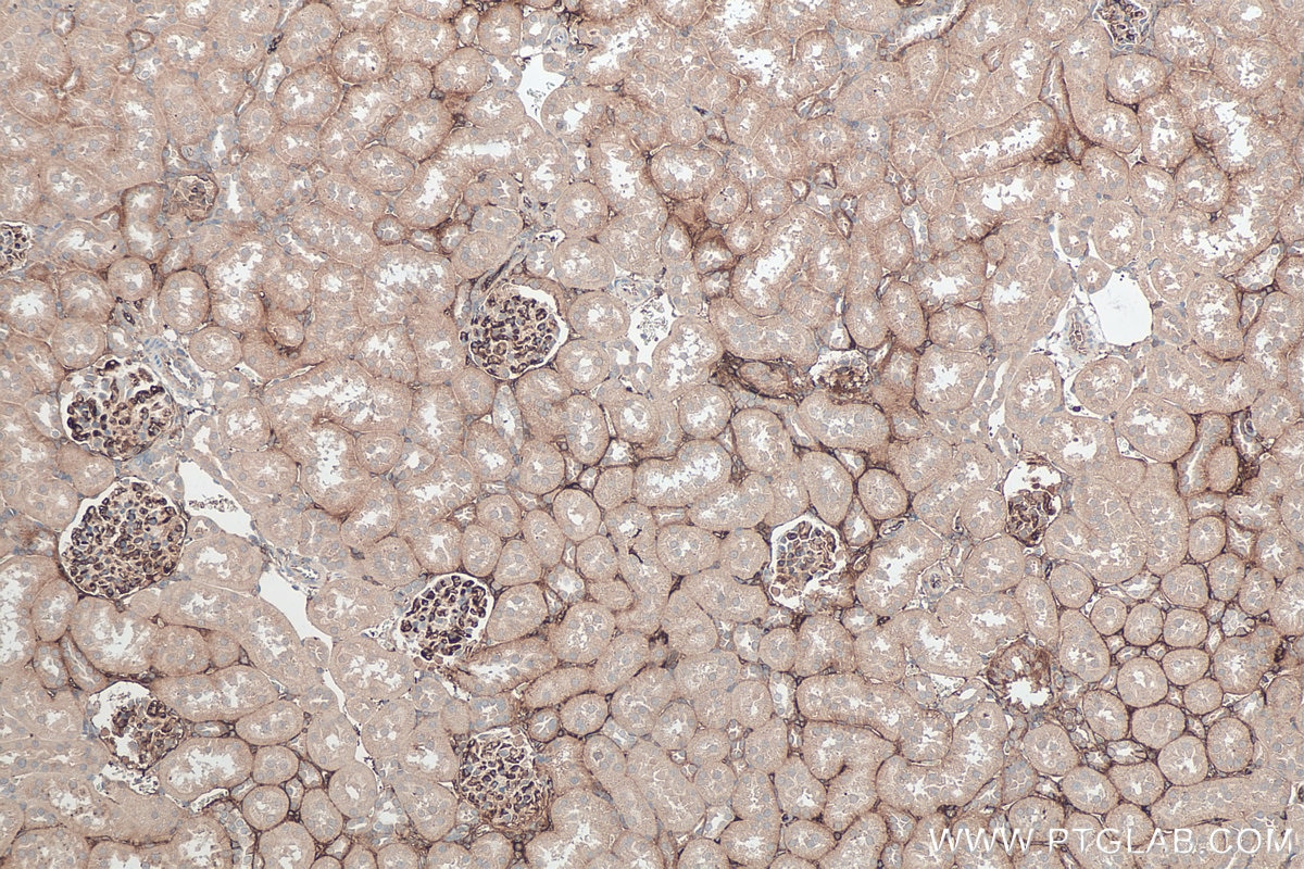 Immunohistochemical analysis of paraffin-embedded rat kidney tissue slide using KHC0388 (Fibrinogen Beta Chain IHC Kit).