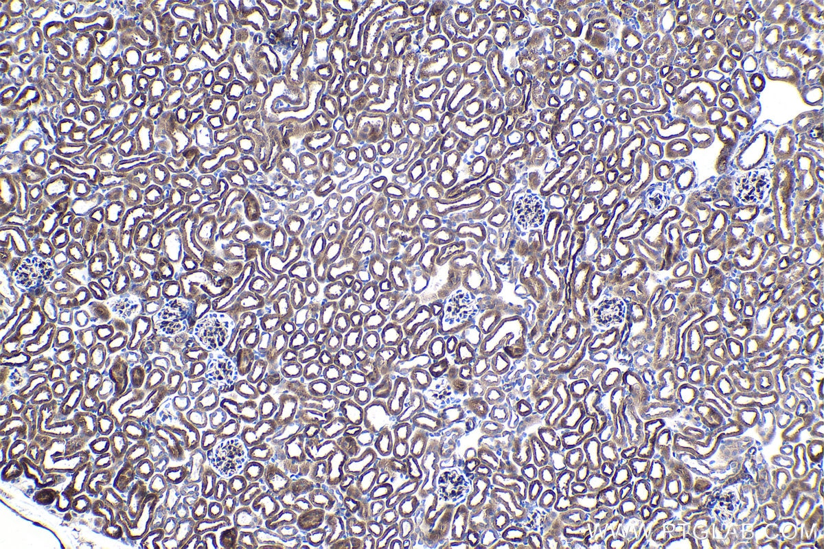 Immunohistochemical analysis of paraffin-embedded mouse kidney tissue slide using KHC1508 (FGF1 IHC Kit).
