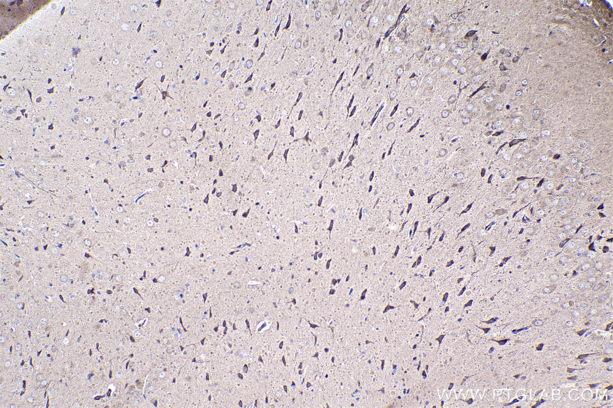 Immunohistochemical analysis of paraffin-embedded rat brain tissue slide using KHC1508 (FGF1 IHC Kit).