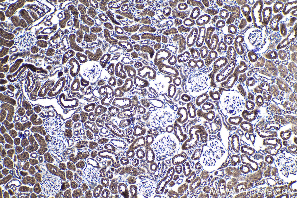Immunohistochemical analysis of paraffin-embedded rat kidney tissue slide using KHC1508 (FGF1 IHC Kit).