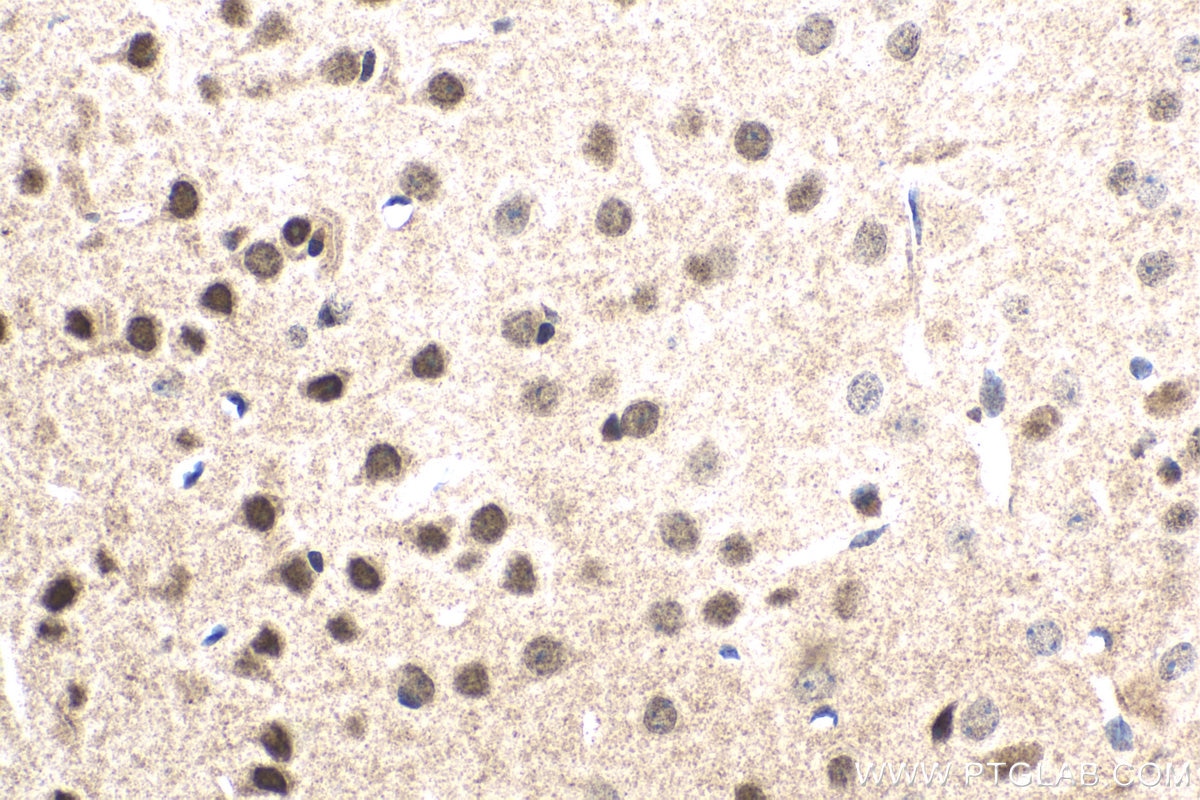 Immunohistochemical analysis of paraffin-embedded mouse brain tissue slide using KHC1516 (FGF2 IHC Kit).