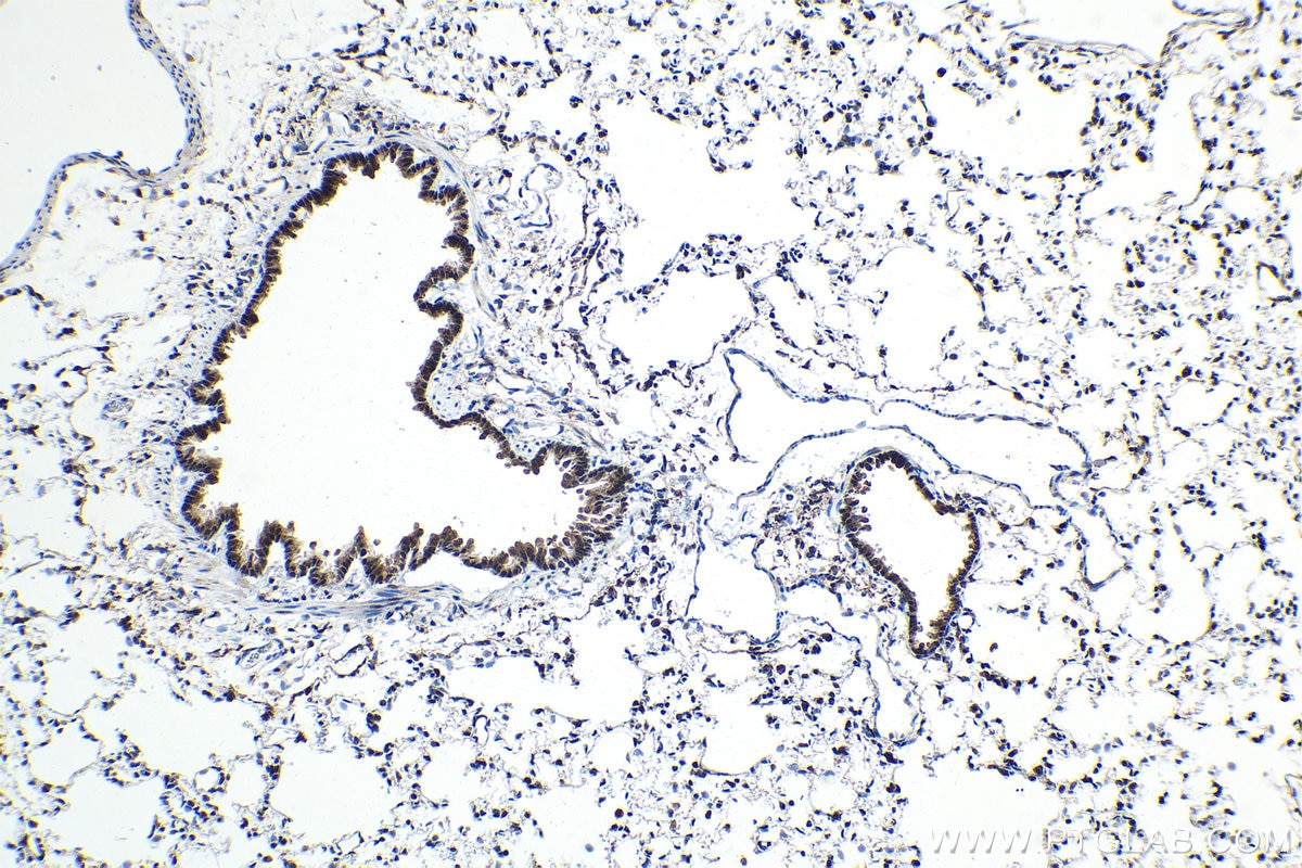 Immunohistochemical analysis of paraffin-embedded rat lung tissue slide using KHC1516 (FGF2 IHC Kit).