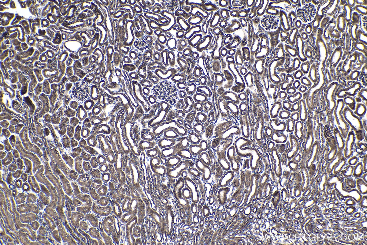 Immunohistochemical analysis of paraffin-embedded mouse kidney tissue slide using KHC1056 (FGFR3 IHC Kit).