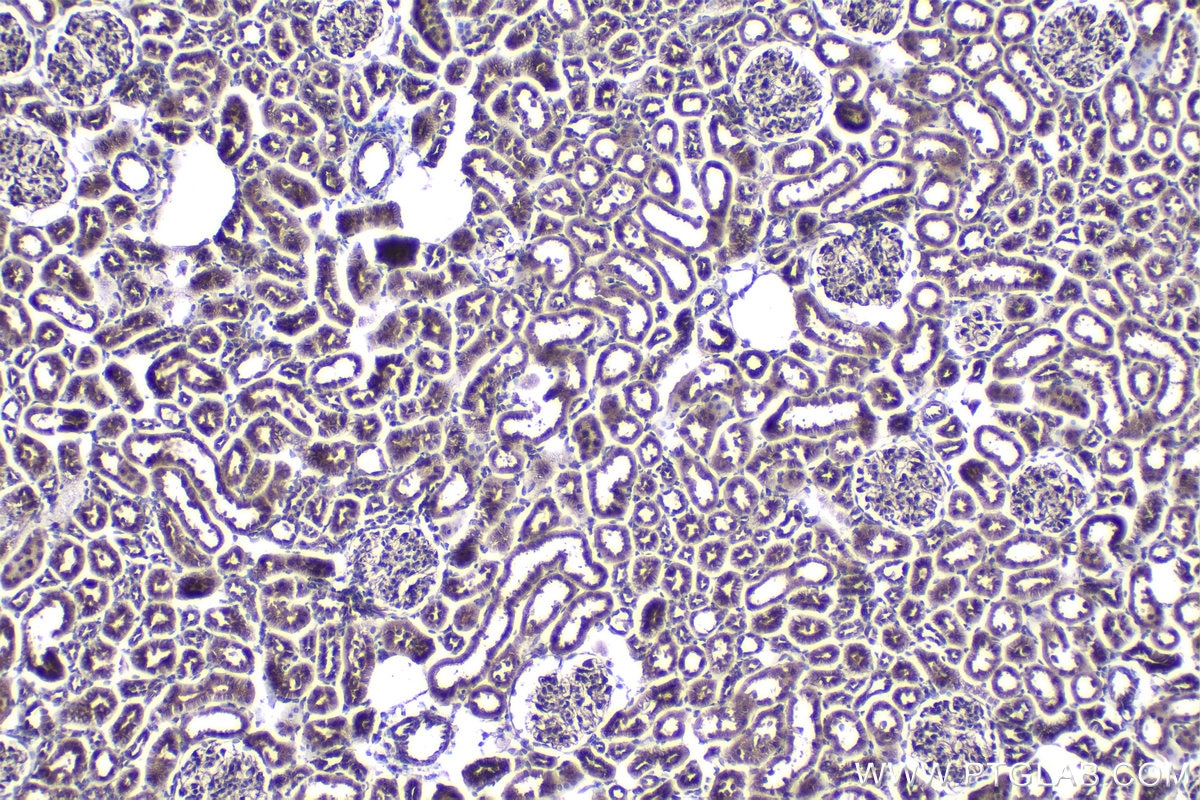 Immunohistochemical analysis of paraffin-embedded rat kidney tissue slide using KHC1056 (FGFR3 IHC Kit).