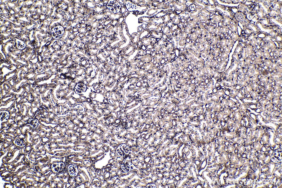 Immunohistochemical analysis of paraffin-embedded mouse kidney tissue slide using KHC1727 (FHL2 IHC Kit).
