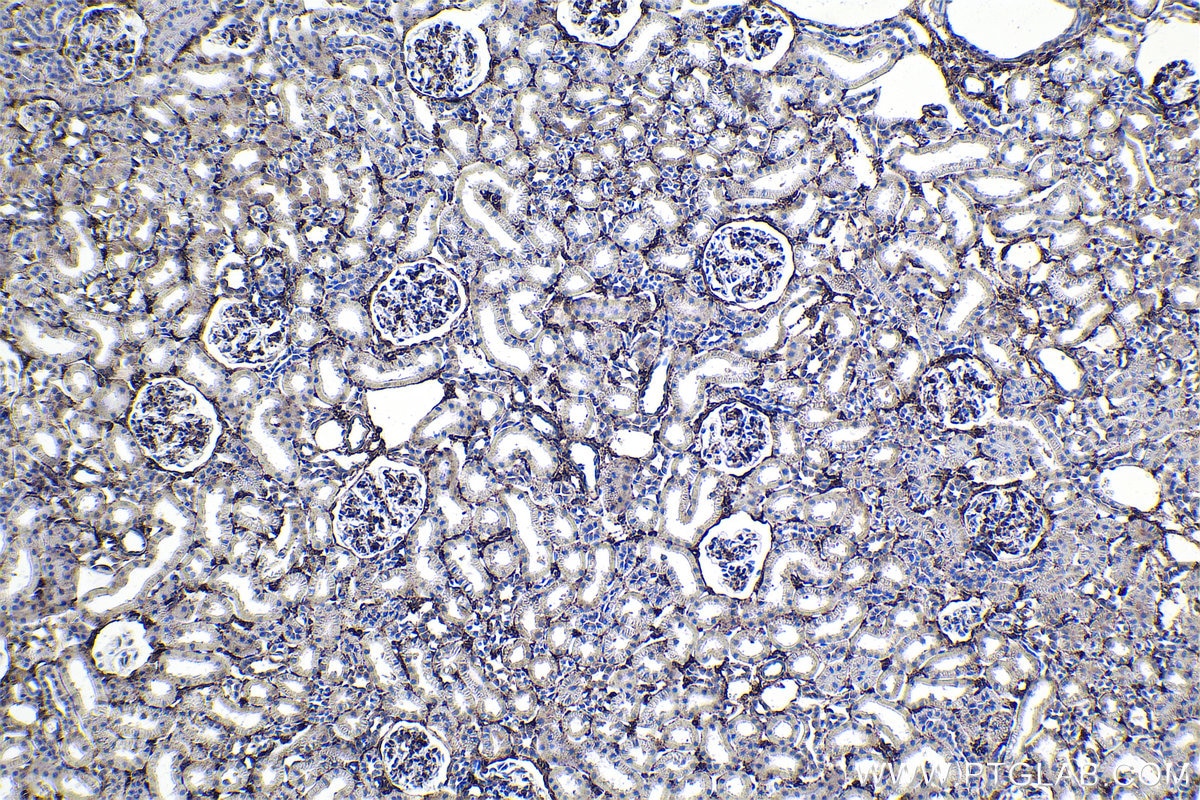 Immunohistochemical analysis of paraffin-embedded rat kidney tissue slide using KHC1727 (FHL2 IHC Kit).