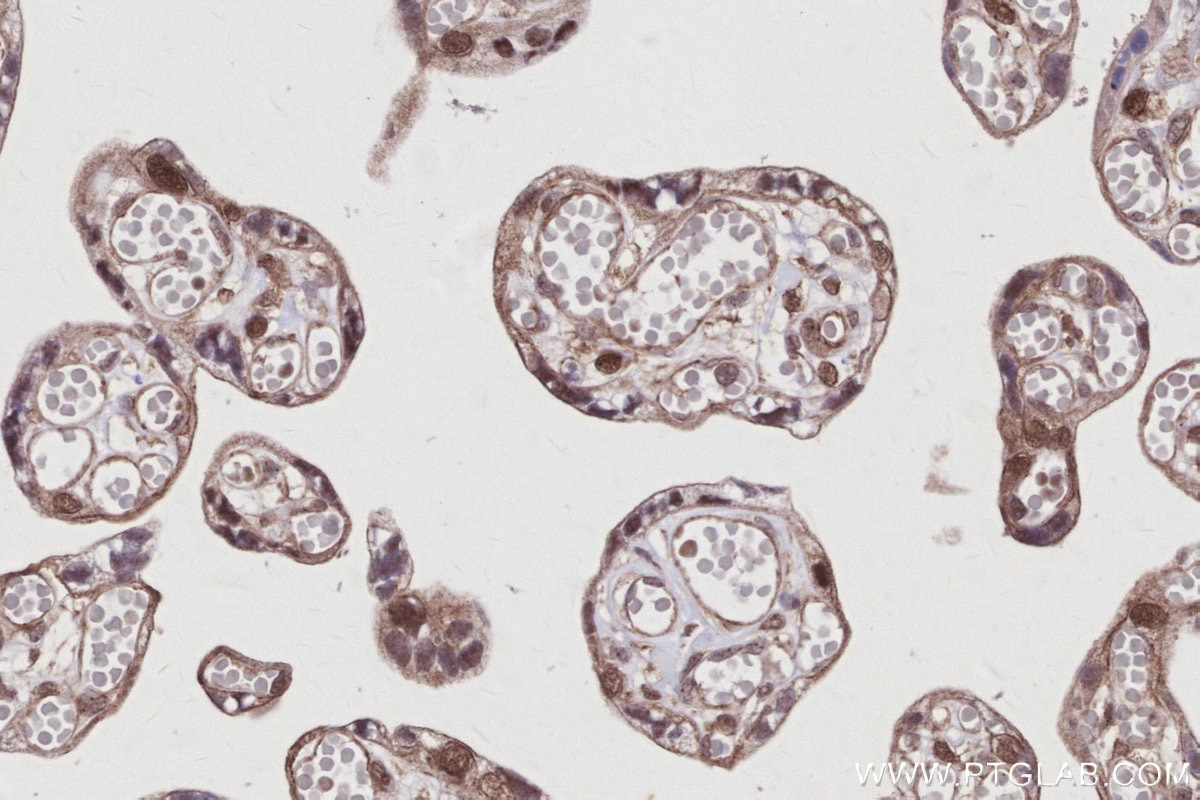 Immunohistochemical analysis of paraffin-embedded human placenta tissue slide using KHC2952 (FIRRM/C1orf112 IHC Kit). Immunohistochemical analysis of paraffin-embedded human placenta tissue slide using KHC2952 (FIRRM/C1orf112 IHC Kit).