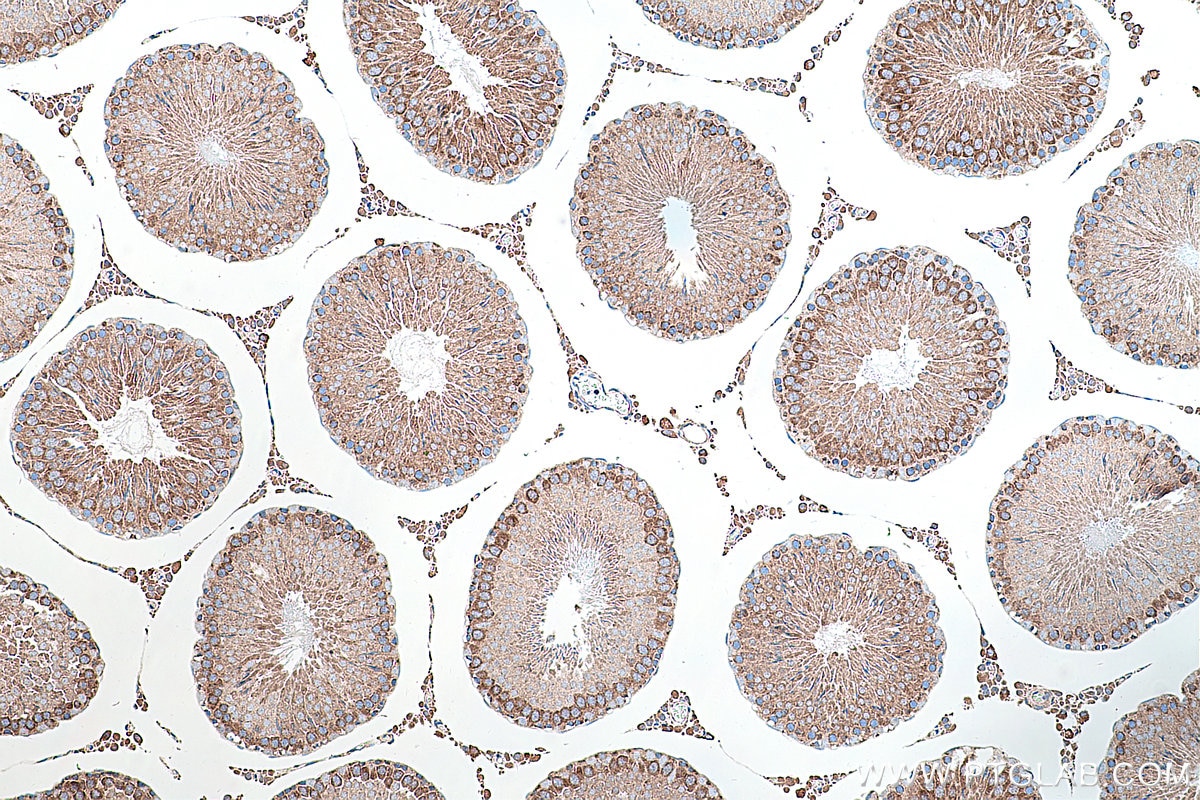 Immunohistochemical analysis of paraffin-embedded rat testis tissue slide using KHC0217 (VEGFR-1/FLT-1 IHC Kit).