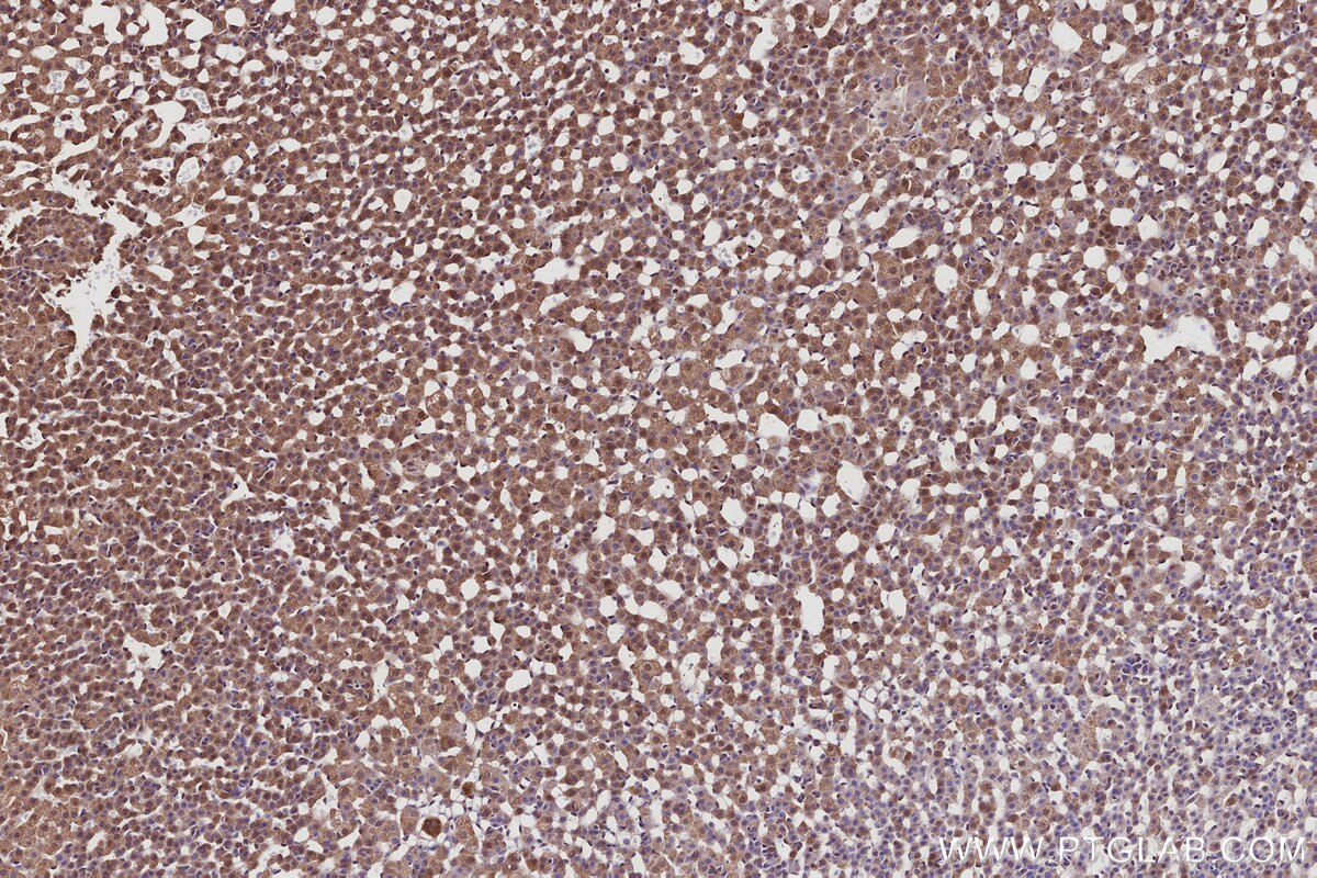 Immunohistochemical analysis of paraffin-embedded rat adrenal gland tissue slide using KHC2978 (FMN2 IHC Kit).