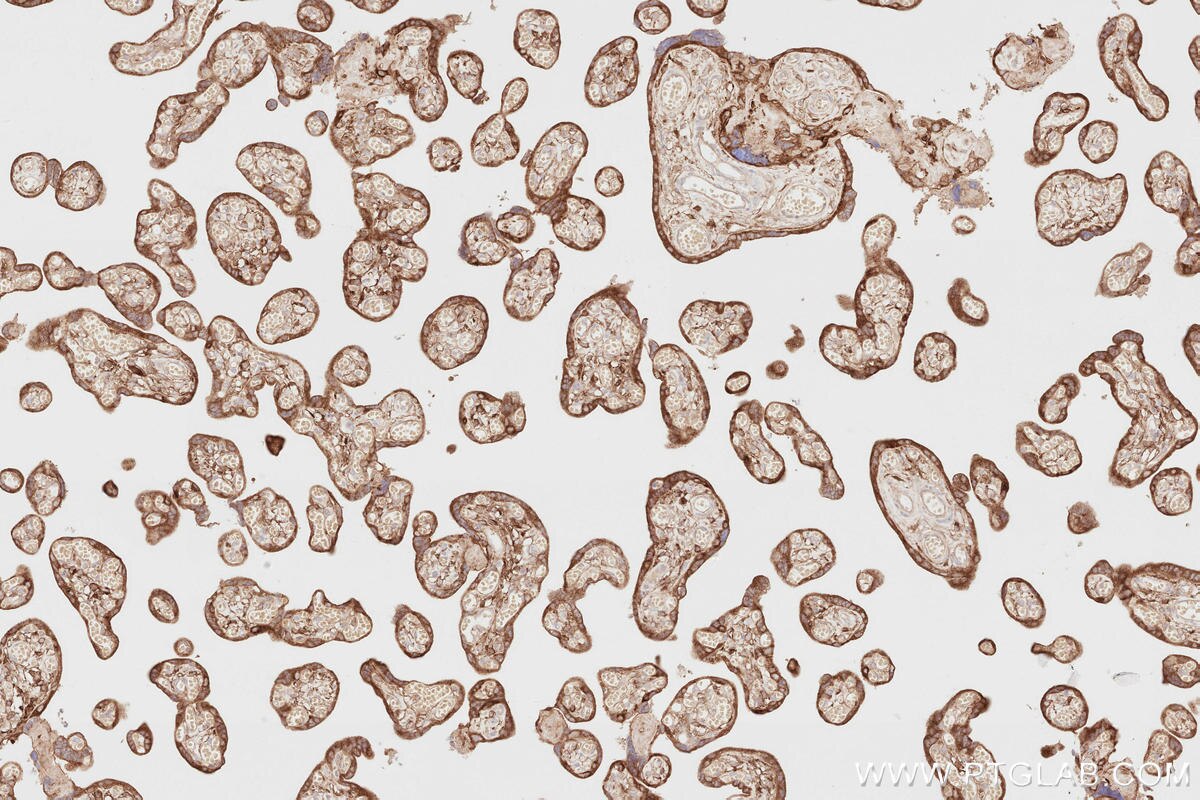 Immunohistochemical analysis of paraffin-embedded human placenta tissue slide using KHC2816 (FMNL2 IHC Kit).