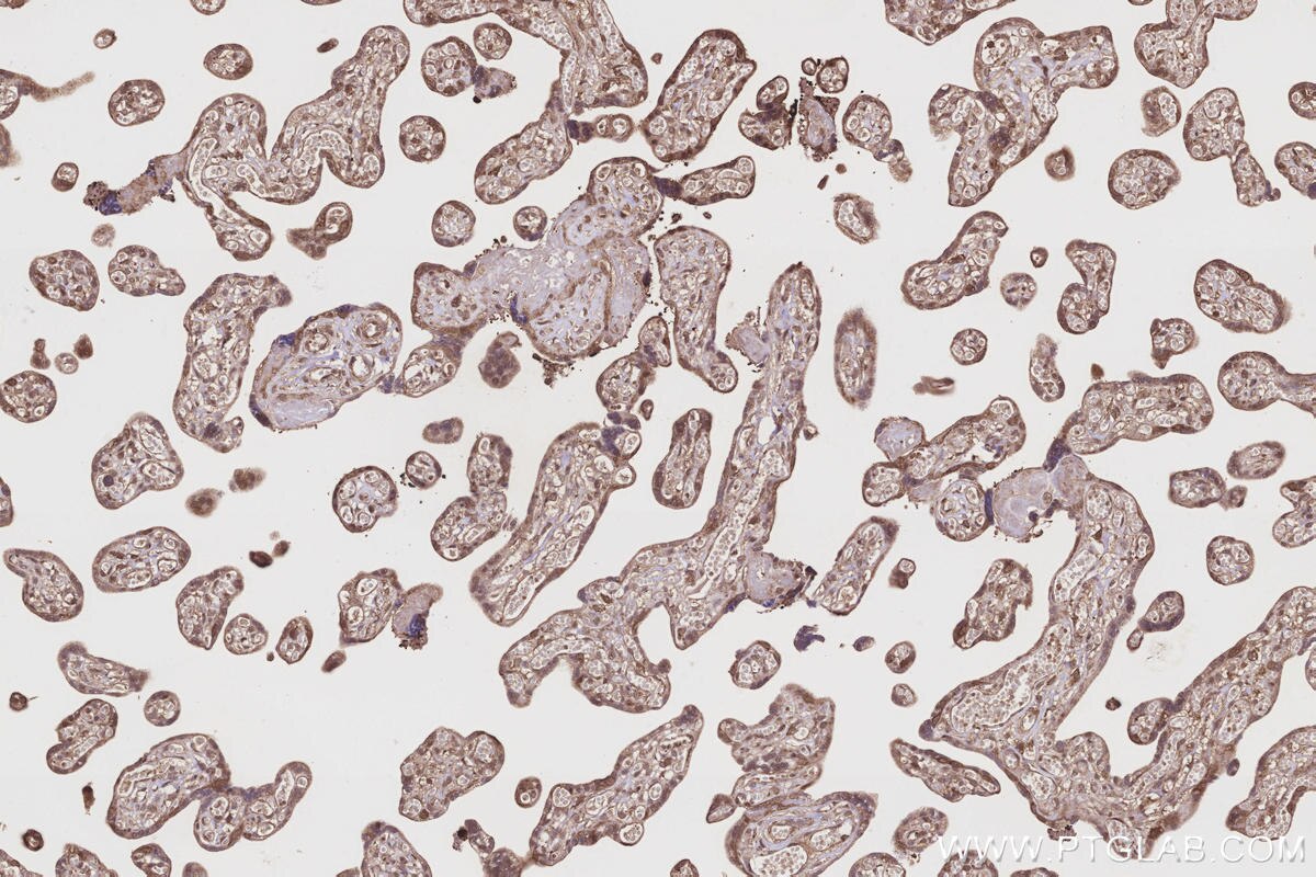 Immunohistochemical analysis of paraffin-embedded human placenta tissue slide using KHC3216 (FNTA IHC Kit). Immunohistochemical analysis of paraffin-embedded human placenta tissue slide using KHC3216 (FNTA IHC Kit).