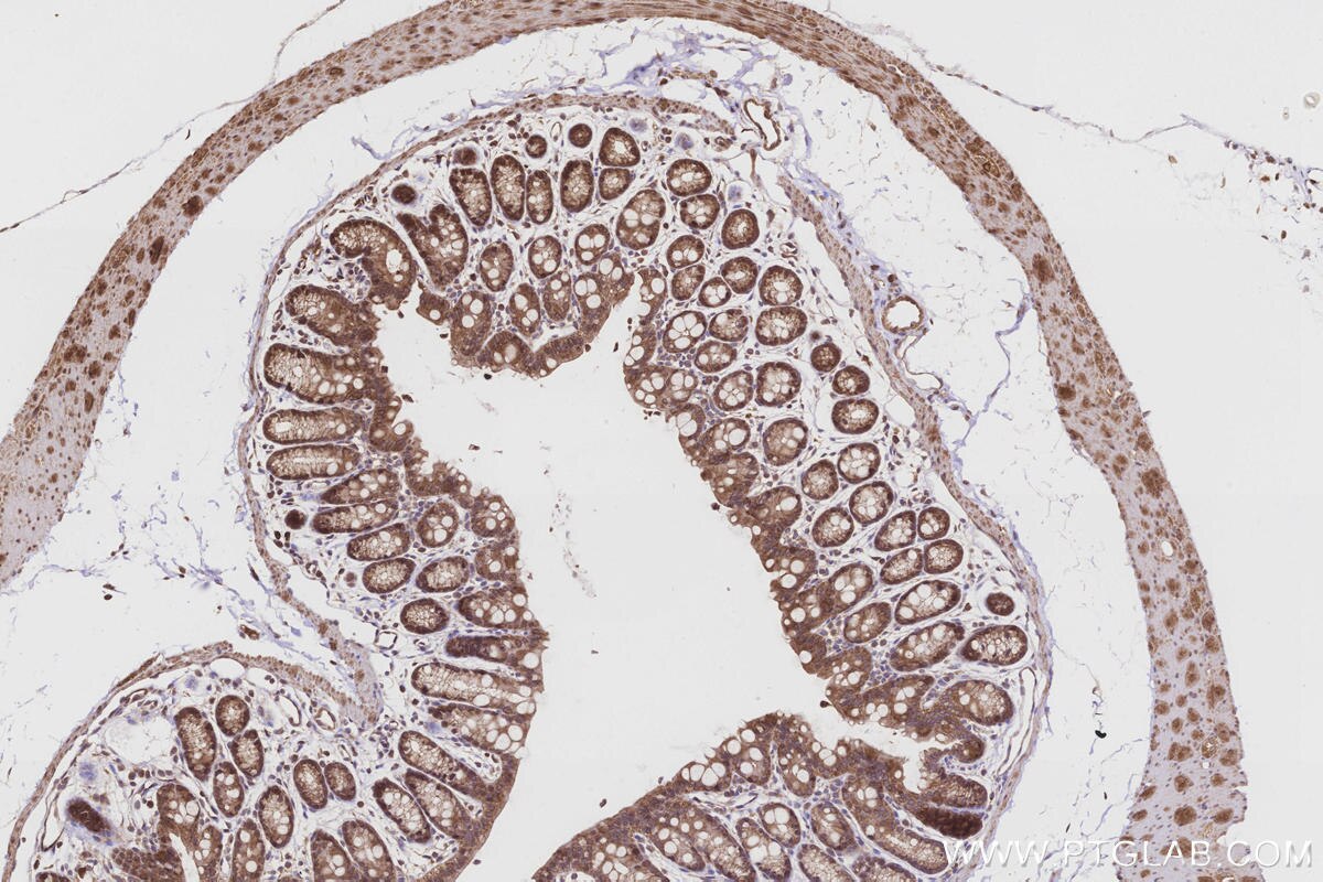 Immunohistochemical analysis of paraffin-embedded mouse colon tissue slide using KHC3216 (FNTA IHC Kit). Immunohistochemical analysis of paraffin-embedded mouse colon tissue slide using KHC3216 (FNTA IHC Kit).