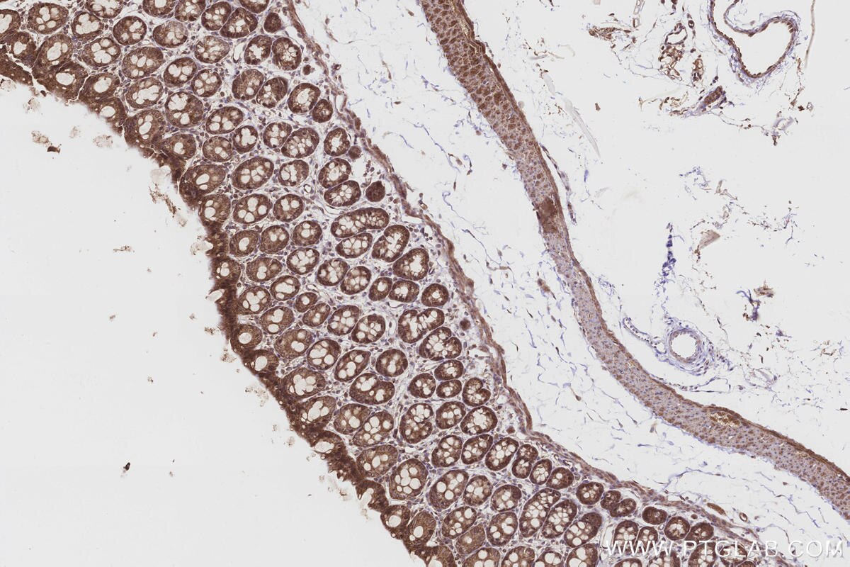 Immunohistochemical analysis of paraffin-embedded rat colon tissue slide using KHC3216 (FNTA IHC Kit). Immunohistochemical analysis of paraffin-embedded rat colon tissue slide using KHC3216 (FNTA IHC Kit).