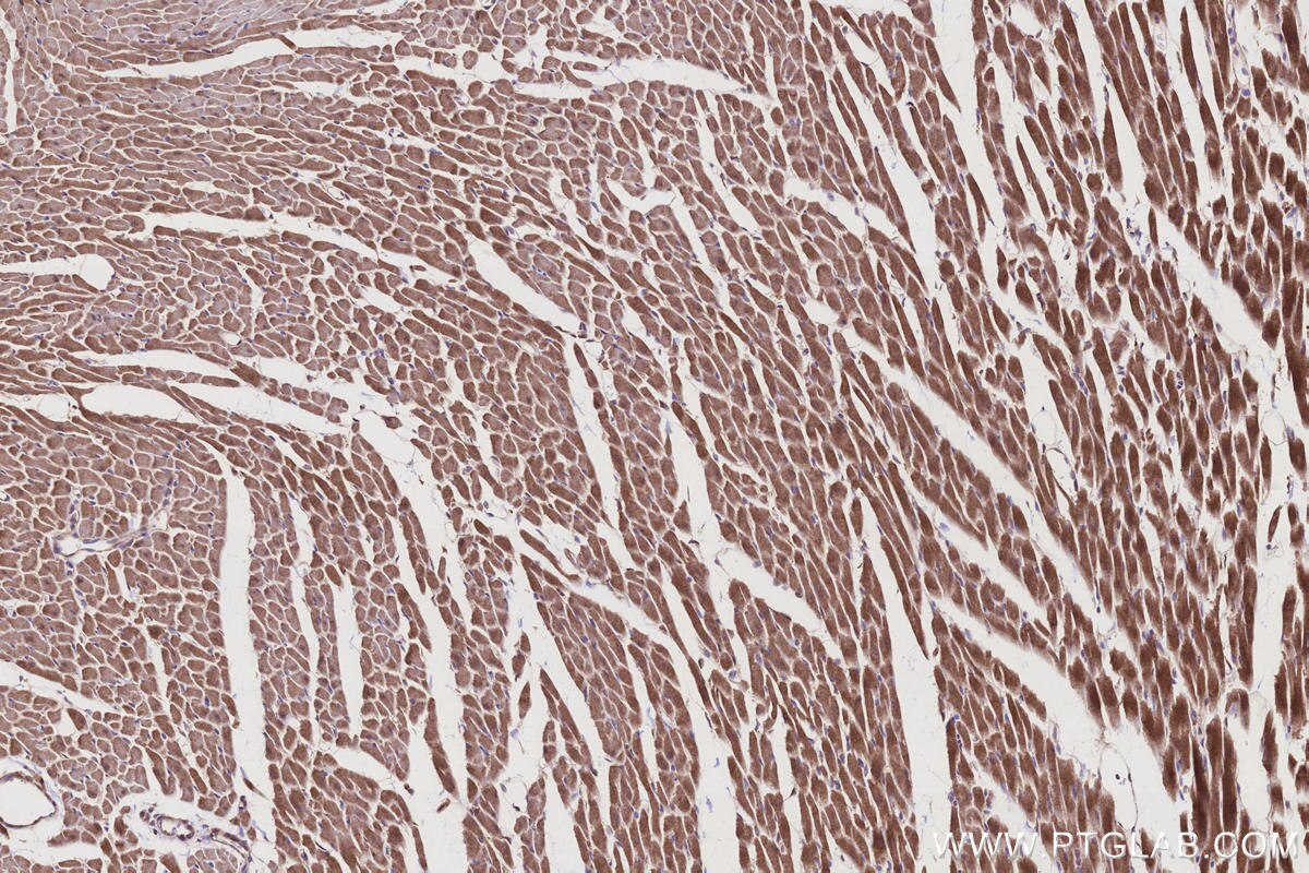 Immunohistochemical analysis of paraffin-embedded rat heart tissue slide using KHC3216 (FNTA IHC Kit). Immunohistochemical analysis of paraffin-embedded rat heart tissue slide using KHC3216 (FNTA IHC Kit).