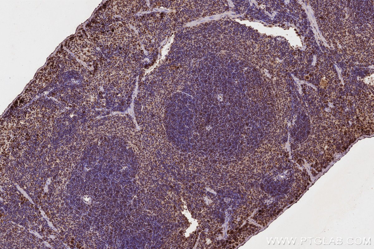 Immunohistochemical analysis of paraffin-embedded mouse spleen tissue slide using KHC3217 (FNTB IHC Kit). Immunohistochemical analysis of paraffin-embedded mouse spleen tissue slide using KHC3217 (FNTB IHC Kit).