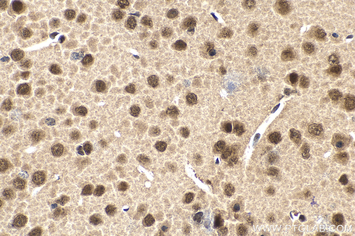 Immunohistochemical analysis of paraffin-embedded mouse brain tissue slide using KHC1451 (FOX2/RBM9 IHC Kit).