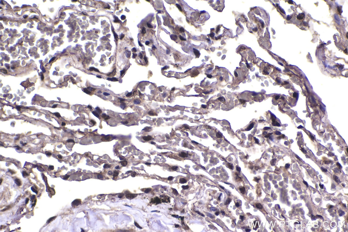 Immunohistochemical analysis of paraffin-embedded human lung tissue slide using KHC1451 (FOX2/RBM9 IHC Kit).