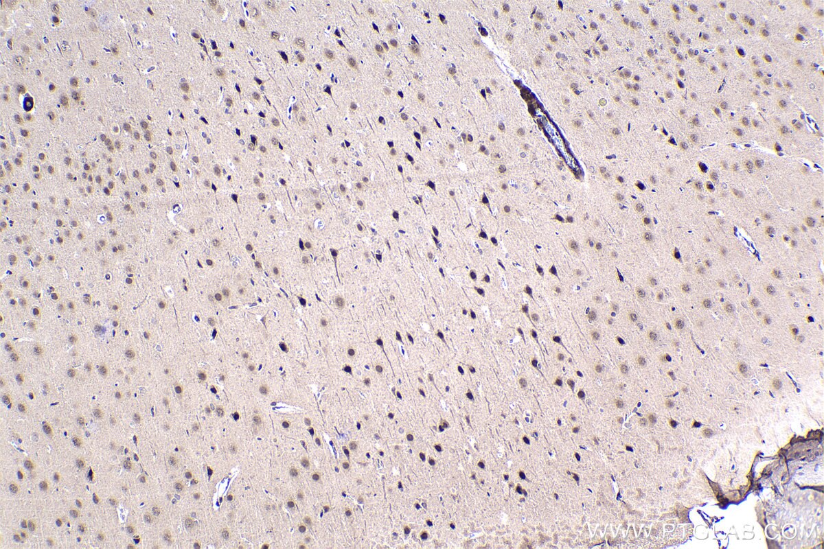 Immunohistochemical analysis of paraffin-embedded rat brain tissue slide using KHC1451 (FOX2/RBM9 IHC Kit).