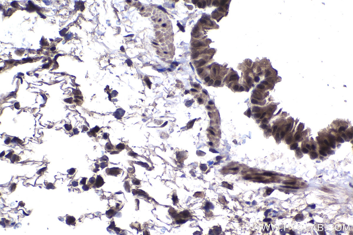 Immunohistochemical analysis of paraffin-embedded rat lung tissue slide using KHC1451 (FOX2/RBM9 IHC Kit).