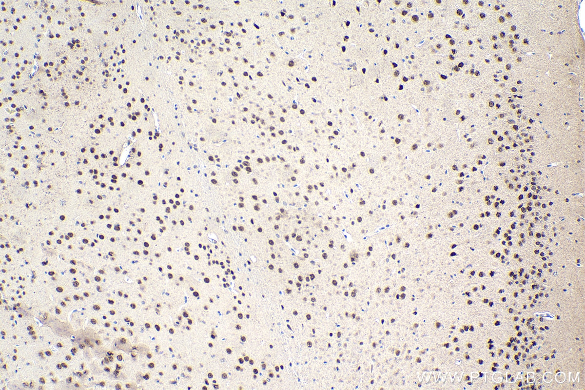 Immunohistochemical analysis of paraffin-embedded mouse brain tissue slide using KHC1663 (FOXK2 IHC Kit).