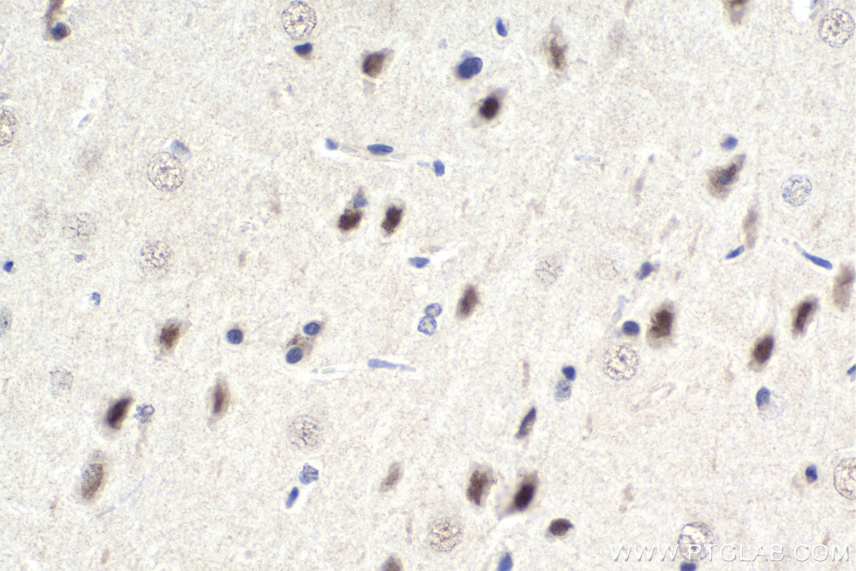 Immunohistochemical analysis of paraffin-embedded rat brain tissue slide using KHC1663 (FOXK2 IHC Kit).