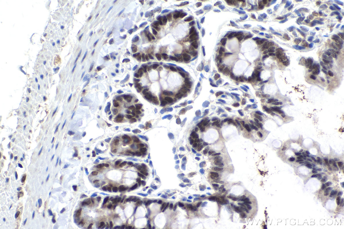 Immunohistochemical analysis of paraffin-embedded rat small intestine tissue slide using KHC1663 (FOXK2 IHC Kit).