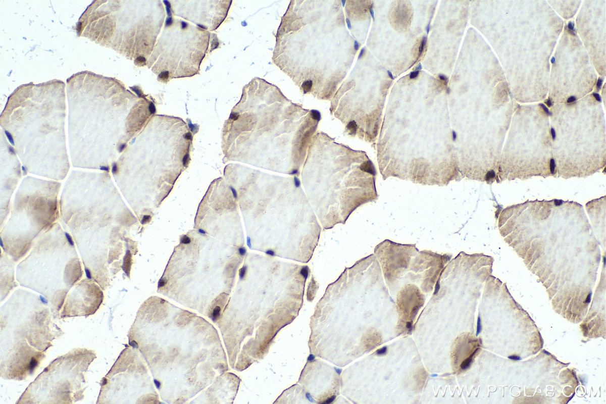 Immunohistochemical analysis of paraffin-embedded mouse skeletal muscle tissue slide using KHC0328 (FOXO1 IHC Kit).