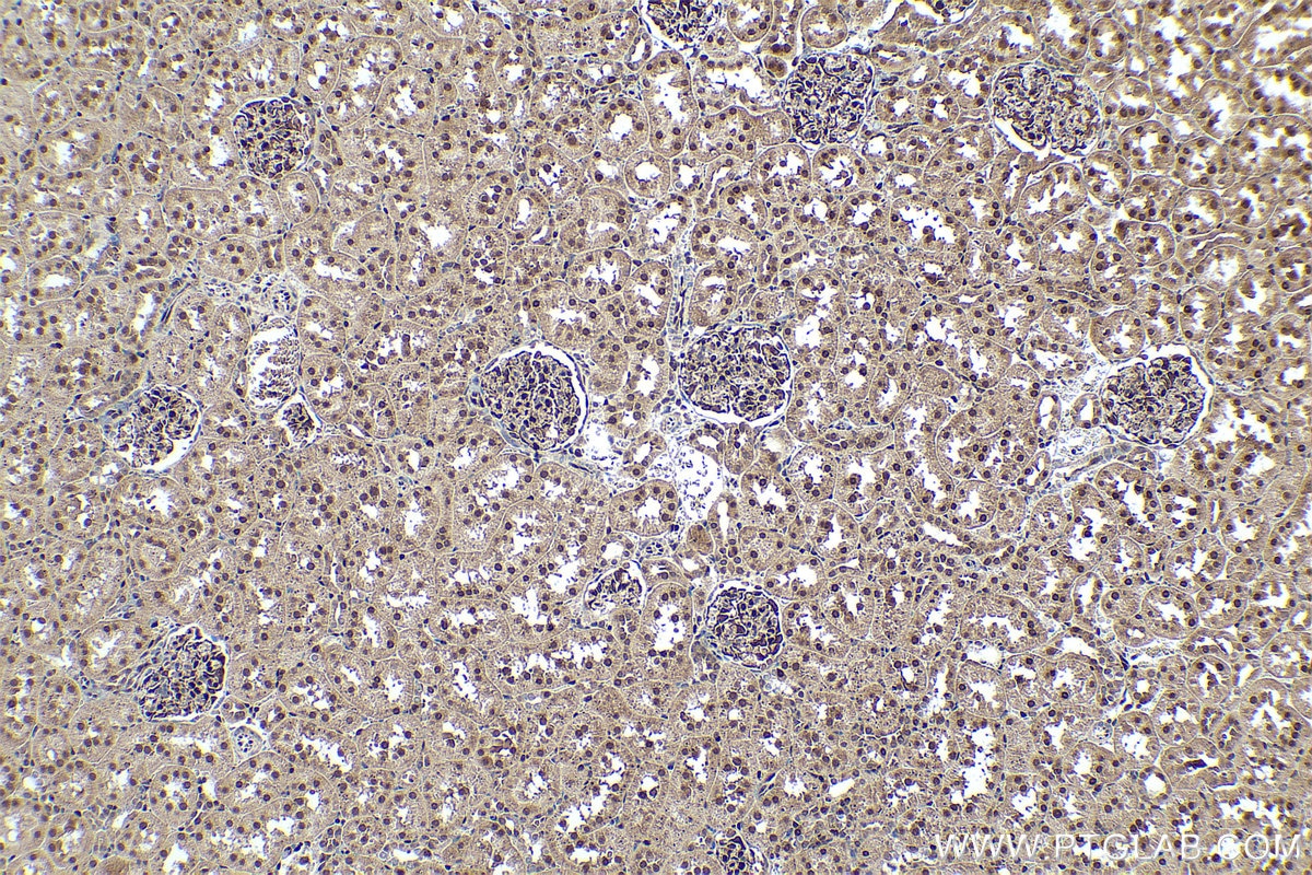 Immunohistochemical analysis of paraffin-embedded rat kidney tissue slide using KHC0328 (FOXO1 IHC Kit).