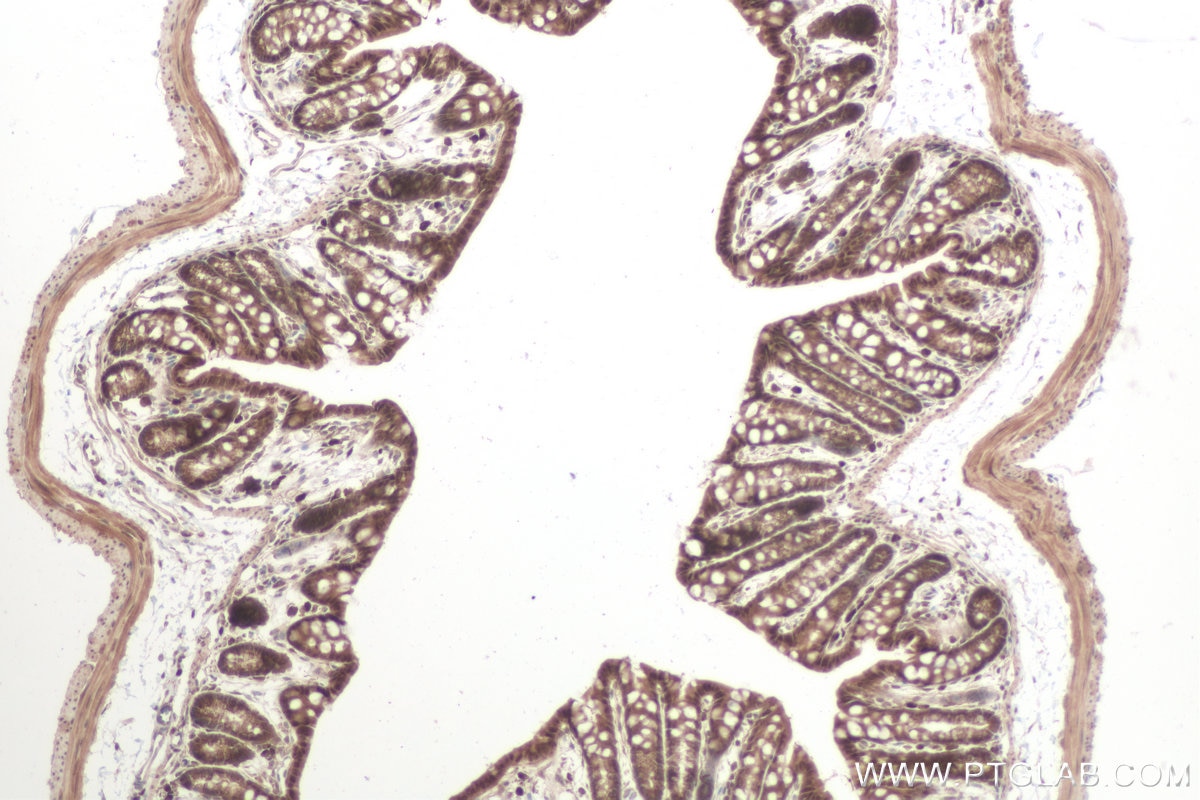 Immunohistochemical analysis of paraffin-embedded mouse colon tissue slide using KHC0815 (FOXO3A IHC Kit).