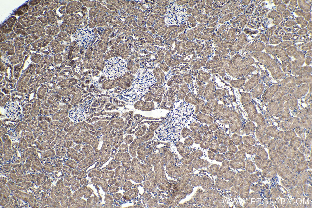 Immunohistochemical analysis of paraffin-embedded rat kidney tissue slide using KHC1656 (FOXO4 IHC Kit).