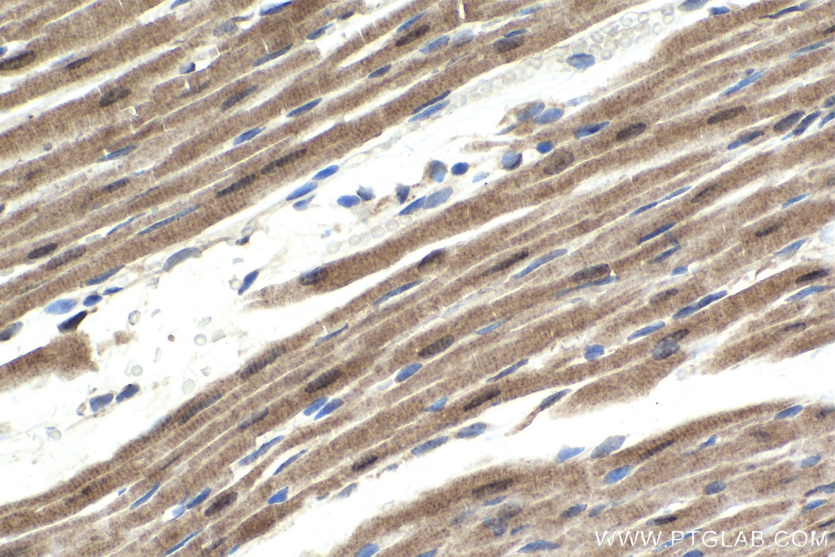 Immunohistochemical analysis of paraffin-embedded rat heart tissue slide using KHC1656 (FOXO4 IHC Kit).