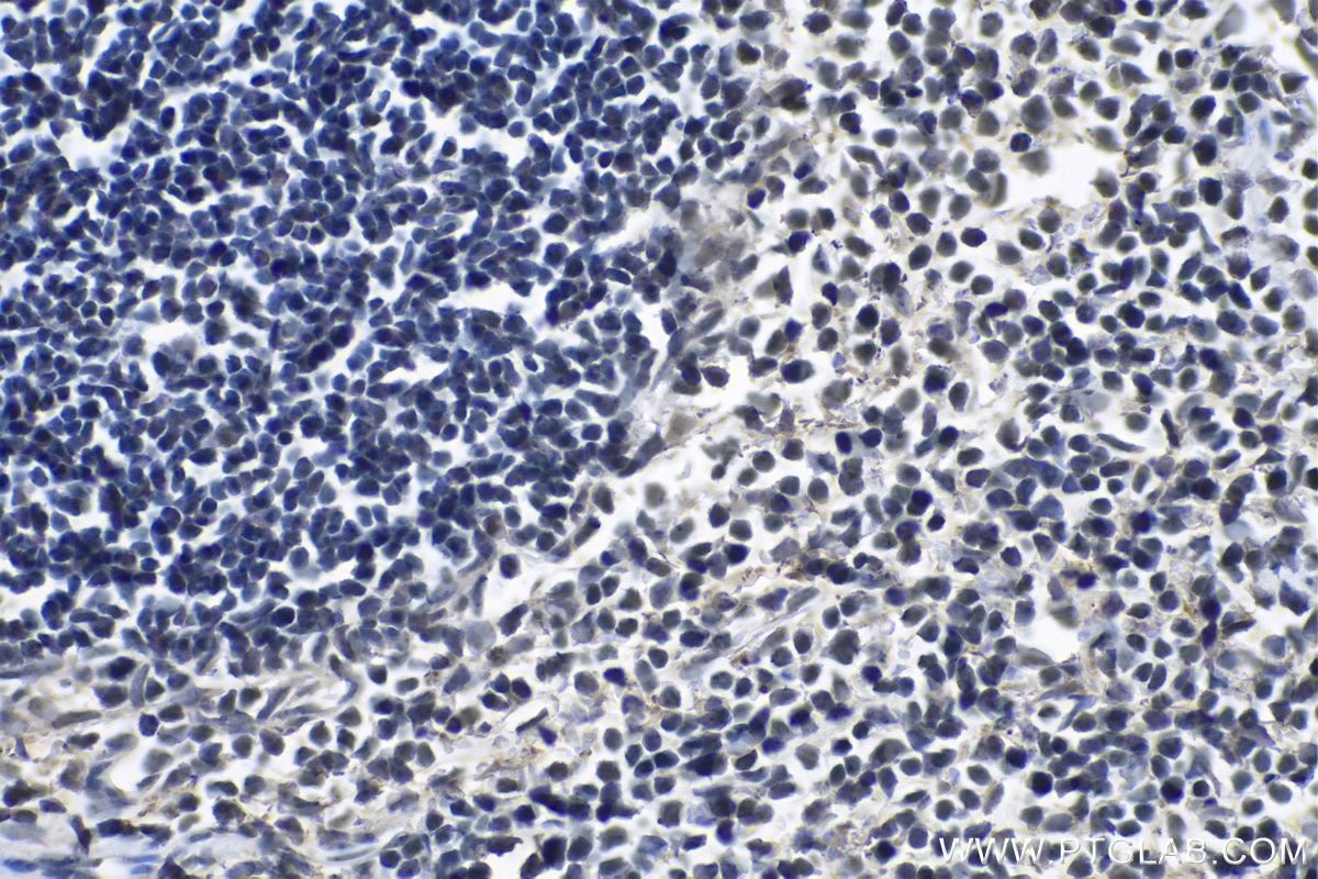 Immunohistochemical analysis of paraffin-embedded mouse spleen tissue slide using KHC1063 (FOXP1 IHC Kit).