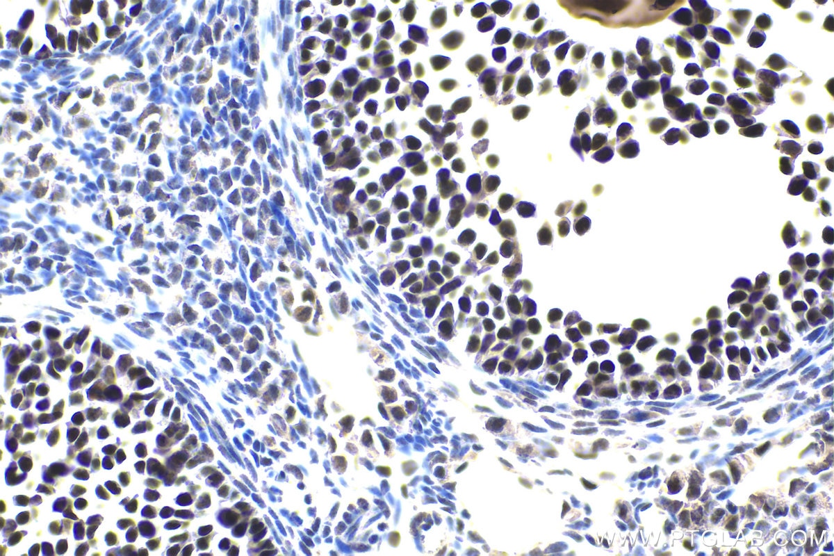 Immunohistochemical analysis of paraffin-embedded mouse ovary tissue slide using KHC1818 (FOXP4 IHC Kit).