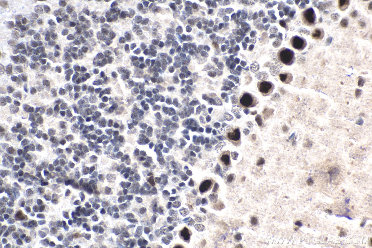 Immunohistochemical analysis of paraffin-embedded mouse cerebellum tissue slide using KHC1818 (FOXP4 IHC Kit).