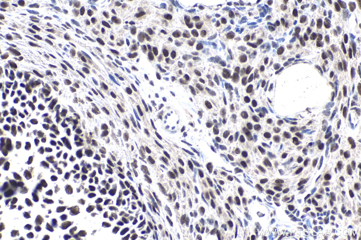 Immunohistochemical analysis of paraffin-embedded rat ovary tissue slide using KHC1818 (FOXP4 IHC Kit).