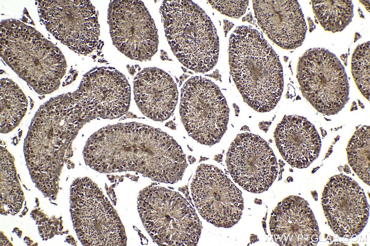 Immunohistochemical analysis of paraffin-embedded mouse testis tissue slide using KHC1790 (FOXR1 IHC Kit).
