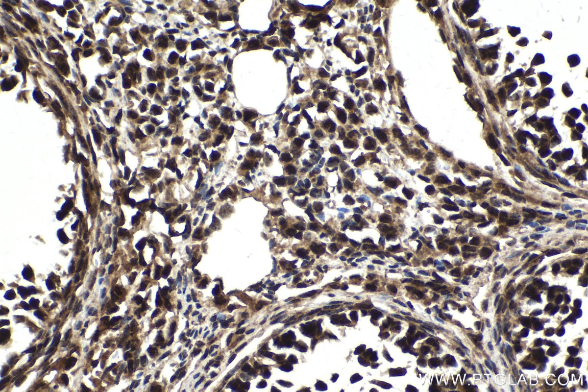 Immunohistochemical analysis of paraffin-embedded mouse ovary tissue slide using KHC1790 (FOXR1 IHC Kit).