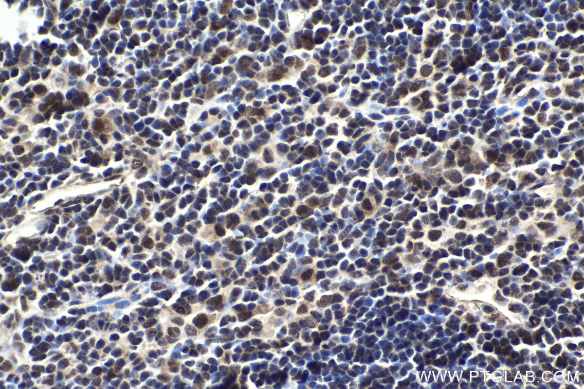 Immunohistochemical analysis of paraffin-embedded mouse thymus tissue slide using KHC1790 (FOXR1 IHC Kit).